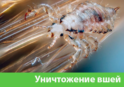 Уничтожение вшей в городе Армавир